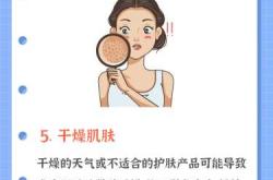 产后为什么会得湿疹呢