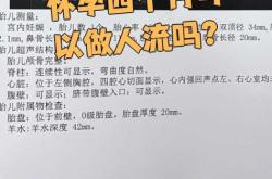 怀孕多久可以进行引产