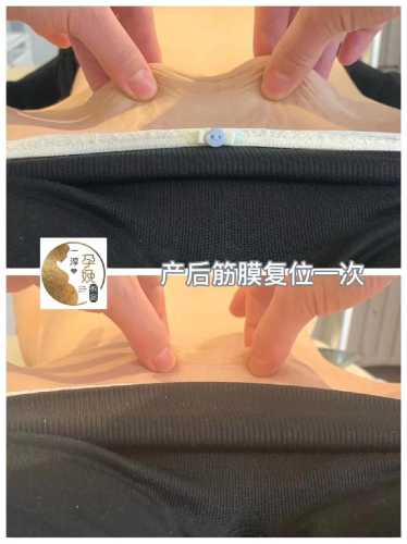 产后松弛的肉该如何解决-第1张图片