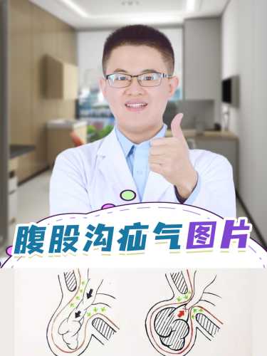 婴儿疝气有哪些症状表现-第1张图片