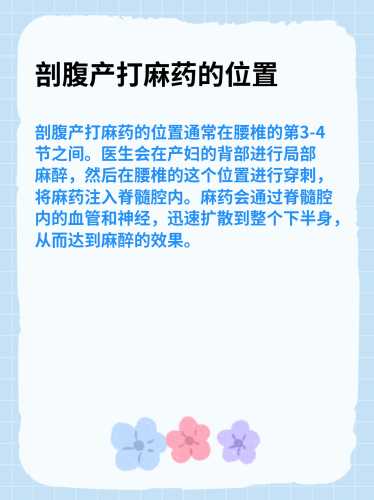 顺产打麻药有必要吗-第1张图片