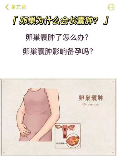 卵巢囊肿备孕半年未复查如何办-第1张图片