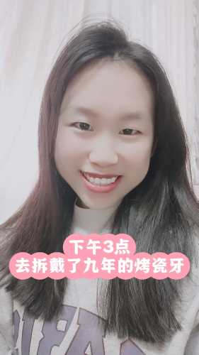 备孕戴烤瓷牙可以吗-第1张图片