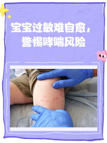 婴儿脸部过敏怎么办-第1张图片