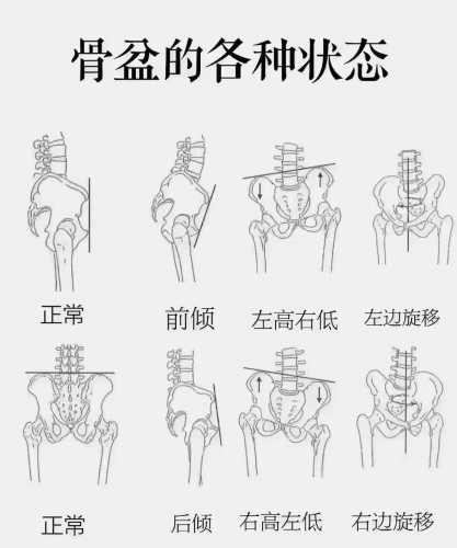 产后一直腰酸是怎么回事-第1张图片