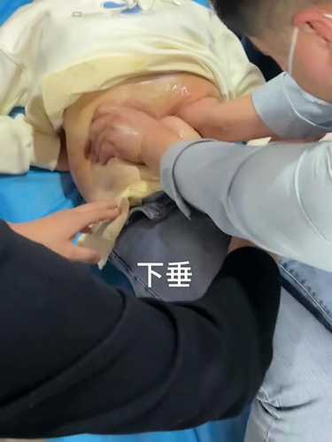 顺产后下腹痛是怎么回事-第1张图片