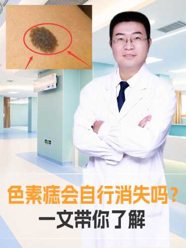婴儿无色素痣该如何应对-第1张图片