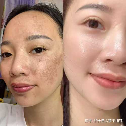 产后脸色暗黄怎么办-第1张图片