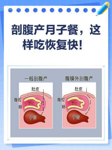 剖腹产不排气能吃饭吗-第1张图片