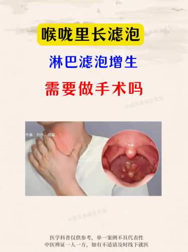 产后慢性咽炎该怎么办-第1张图片