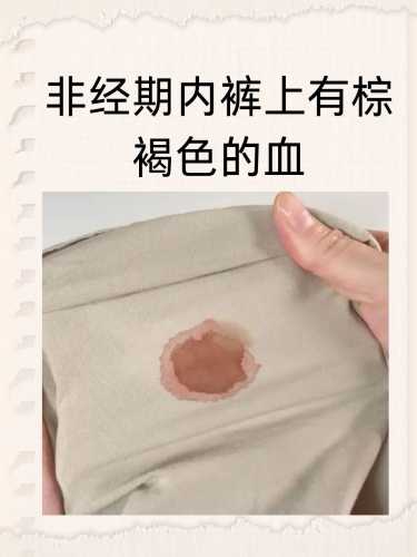 备孕总是排卵期出血咋回事-第1张图片