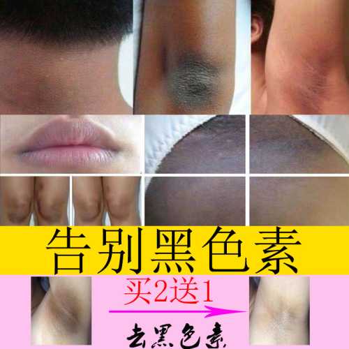 产后身体为何变黑-第1张图片