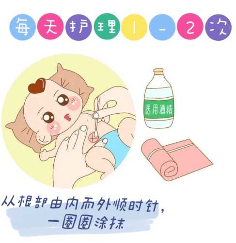 尿不湿需要漏肚脐吗-第1张图片
