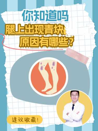 婴儿腿青是怎么回事-第1张图片
