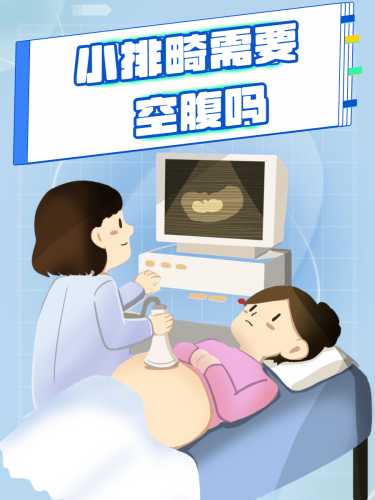 备孕检查需要空腹吗-第1张图片