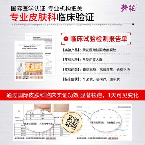 产后妊辰纹可以去除吗-第1张图片
