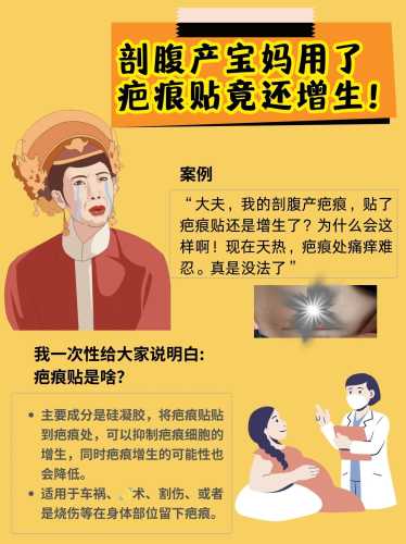 剖腹产巴恨该怎么办-第1张图片