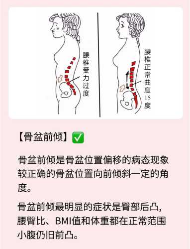 产后胯骨变宽咋恢复运动-第1张图片