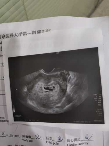 儿子女儿孕反不同吗-第1张图片