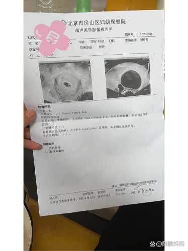 七周孕反不严重正常吗-第1张图片