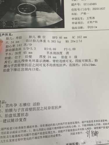 备孕中梦喜小孩咋回事-第1张图片