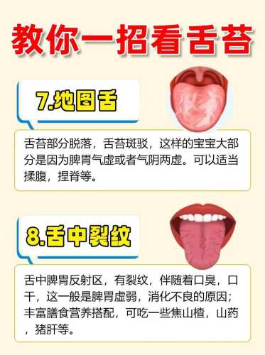 新生儿舌苔厚白怎么办-第1张图片