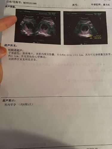 孕反8周5天有什么表现-第1张图片