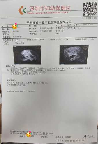 宫外孕手术后多久能怀孕-第1张图片