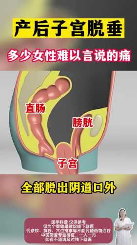 产后子宫低是怎么回事-第1张图片