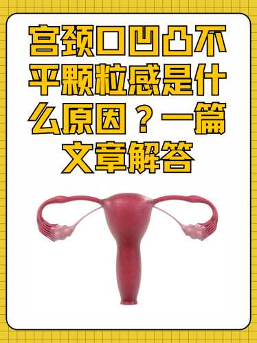 产后宫颈硬是什么原因-第1张图片
