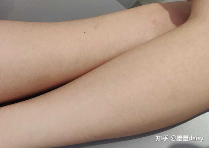 激光脱毛后多久可以怀孕-第1张图片