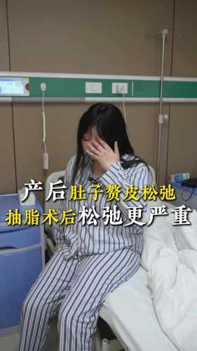 产后肚皮松弛多久可以恢复-第1张图片