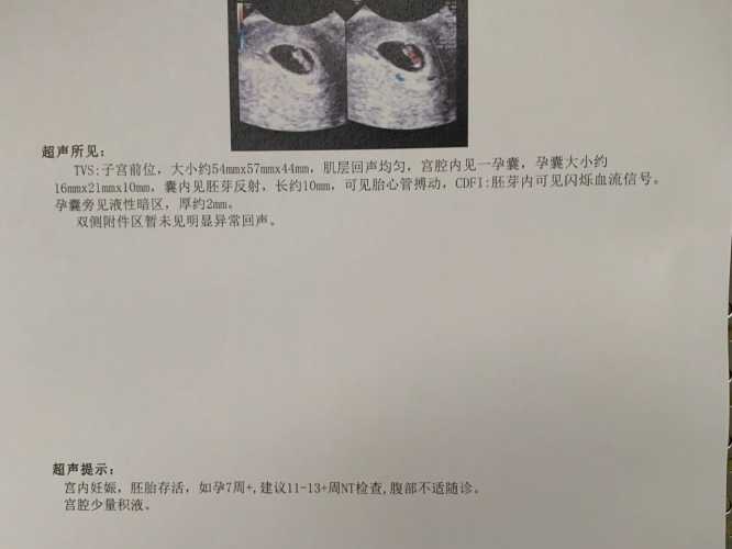 备孕老公梦见我来例假是怎么回事-第1张图片