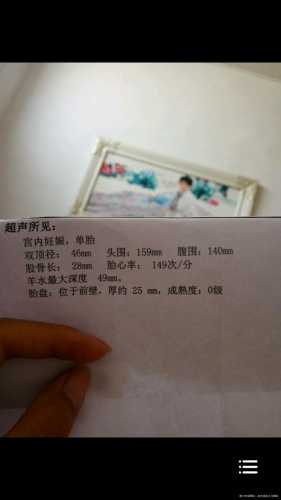 48岁拼4胎备孕好吗-第1张图片