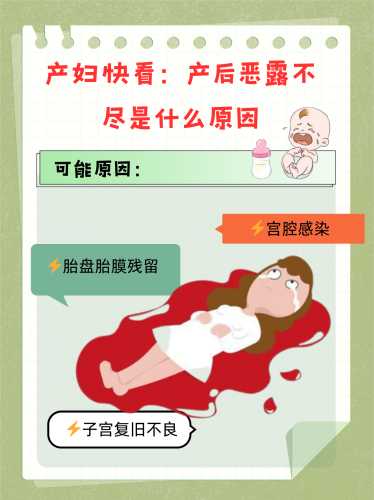 产后恶露4天就没正常吗-第1张图片