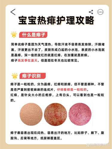 新生儿脸上长湿疹怎么办-第1张图片