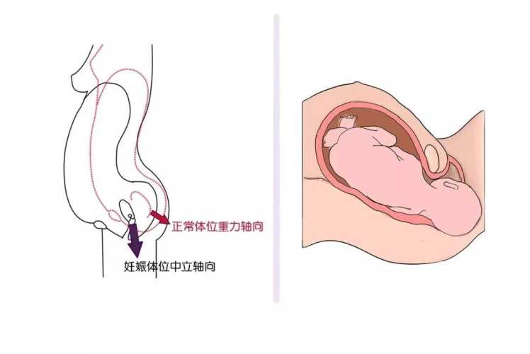 顺产阴道能恢复吗-第1张图片