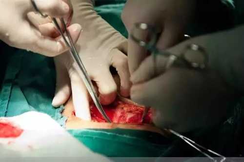 剖腹产全视频在哪看-第1张图片