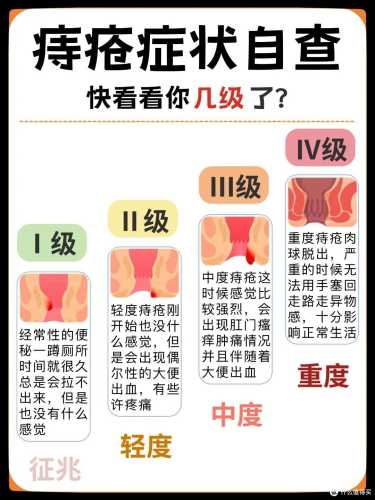 产后长痔疮会自然好吗-第1张图片