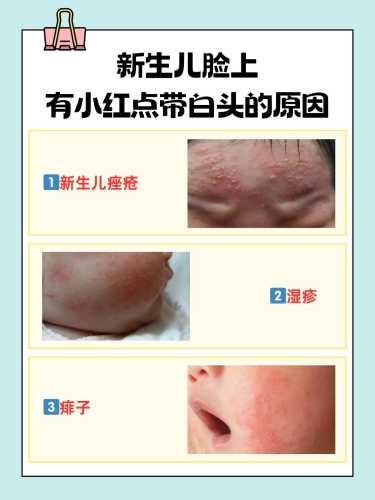 新生儿有点动静就惊醒咋回事-第1张图片