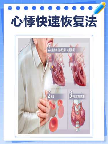 产后老是心悸怎么办-第1张图片
