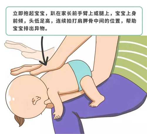 婴儿拍头是怎么回事-第1张图片