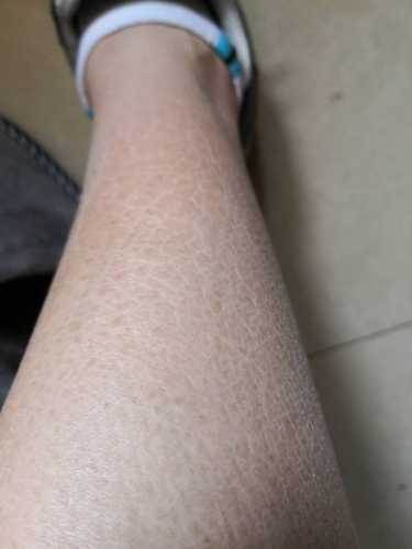 产后汗证是怎么回事-第1张图片