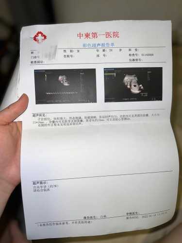 孕十九周孕反结束了吗-第1张图片