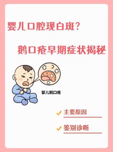 新生儿口腔内要注意什么-第1张图片