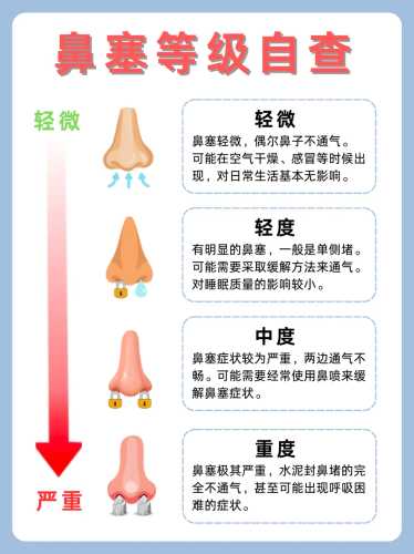 婴儿感冒鼻子不通气怎么办-第1张图片