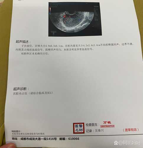 引产后多久能摸冷水-第1张图片
