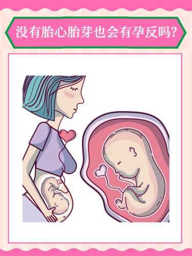 每个孕妈妈都会有孕反吗-第1张图片