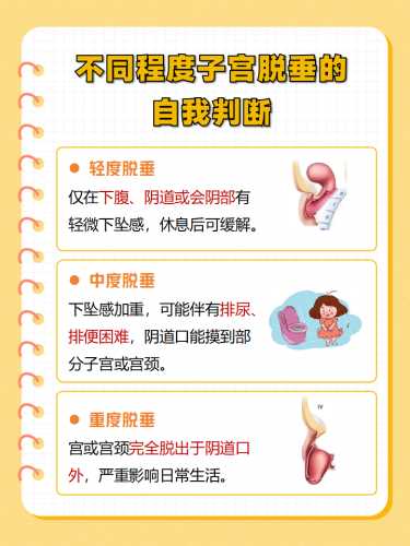 产后下蹲真的会导致子宫下垂吗-第1张图片