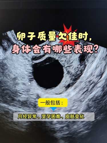 备孕如何做彩超检查卵泡质量-第1张图片